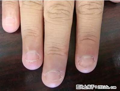 剪指甲、挖耳屎，这些日常小动作竟隐藏大危害！ - 宜昌生活资讯 - 宜昌28生活网 yc.28life.net